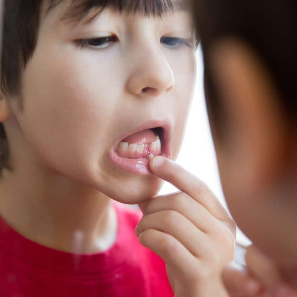 what to do if you break a tooth on the weekend